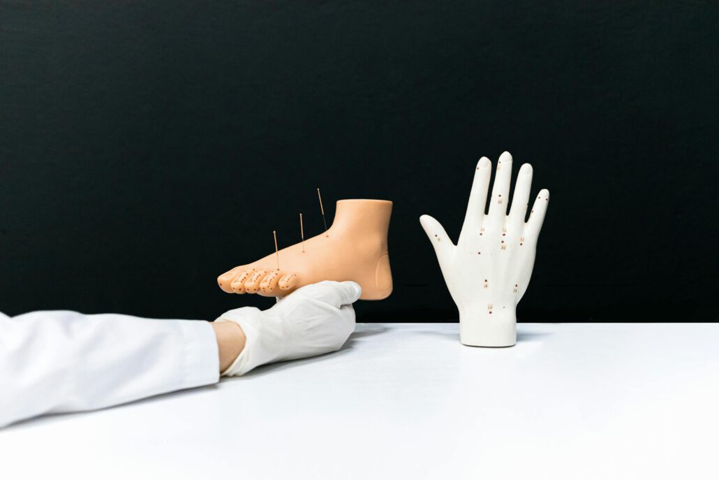 Acupuncture hand and foot models with needles for alternative therapy training.